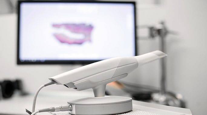 scanner 3D